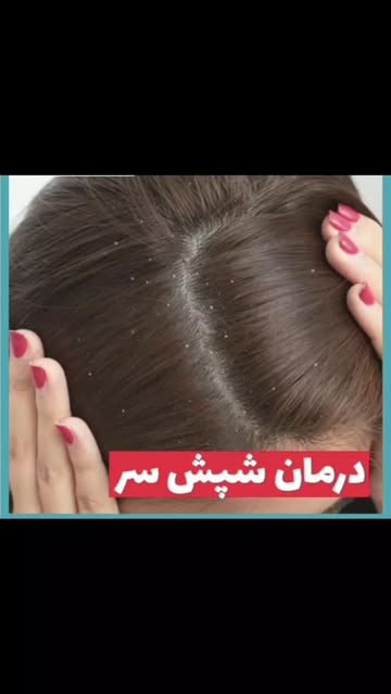 پک درمان شپش