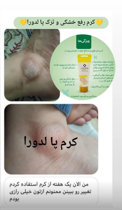 چندمنظوره ترک پا لدورا ۱۰۰ گرمی