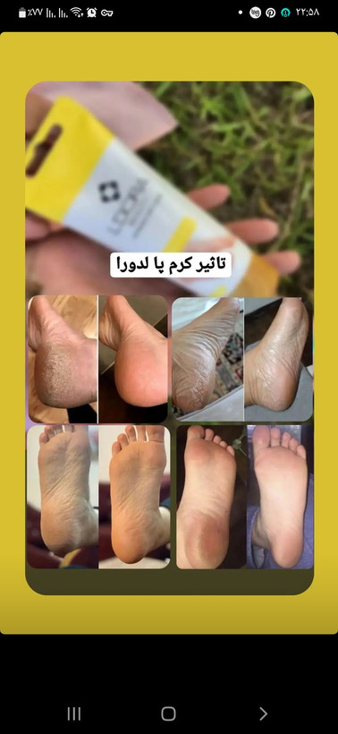 چندمنظوره ترک پا لدورا ۱۰۰ گرمی