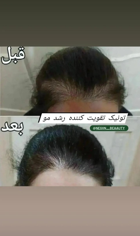 تونیک گیاهی تقویت کننده و ضدریزش موی سر لدورا هربال 40 میلی لیتر
